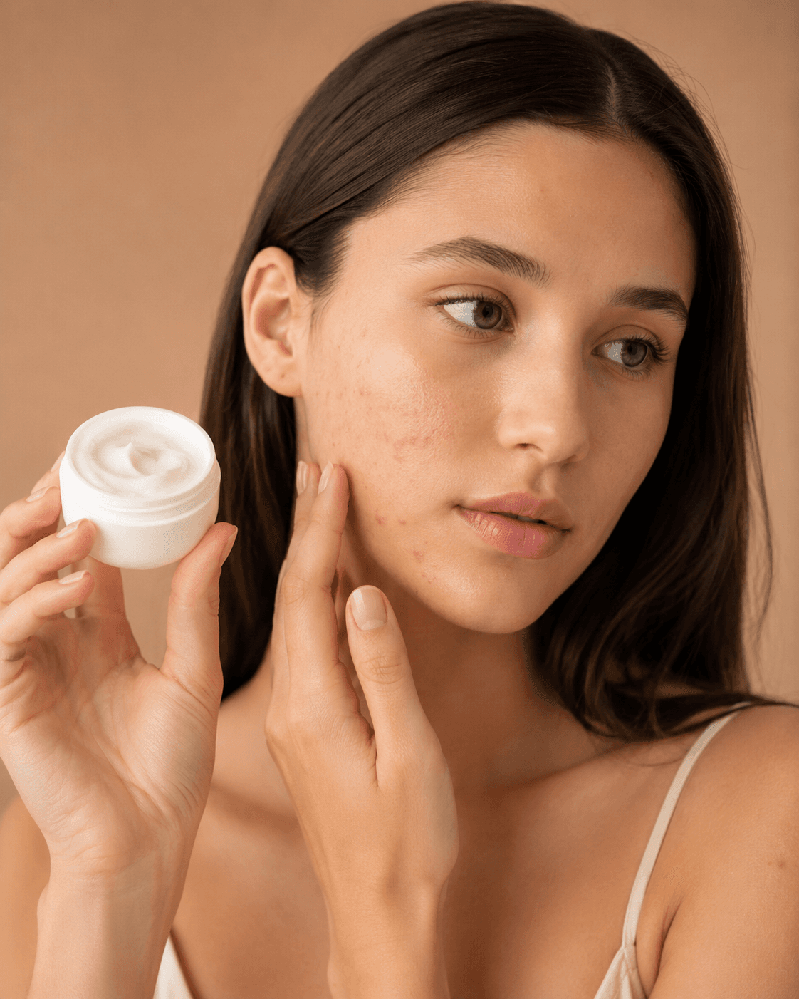 Acne em adolescentes: quando procurar orientação estética